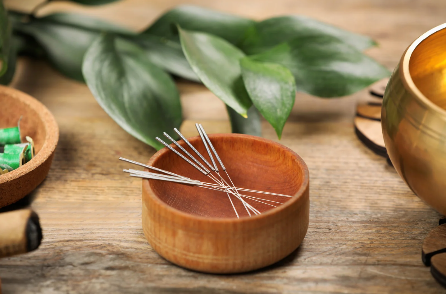 🌿 Why I Fell in Love with Acupuncture (and Why You Might Too)